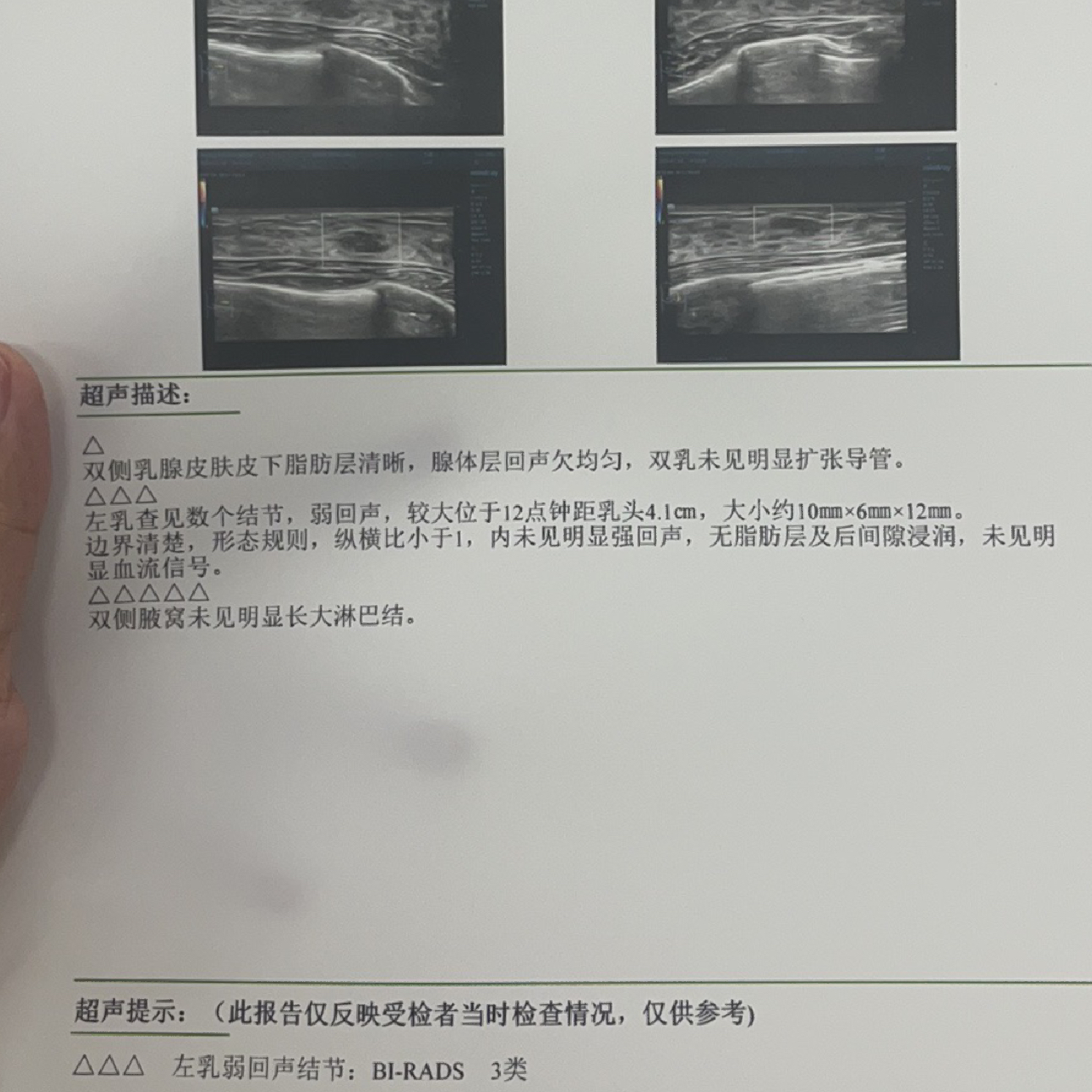 乳腺結(jié)節(jié)3類嚴(yán)重嗎？解讀乳腺健康，讓你了解真相，乳腺結(jié)節(jié)3類嚴(yán)重嗎？解讀乳腺健康真相