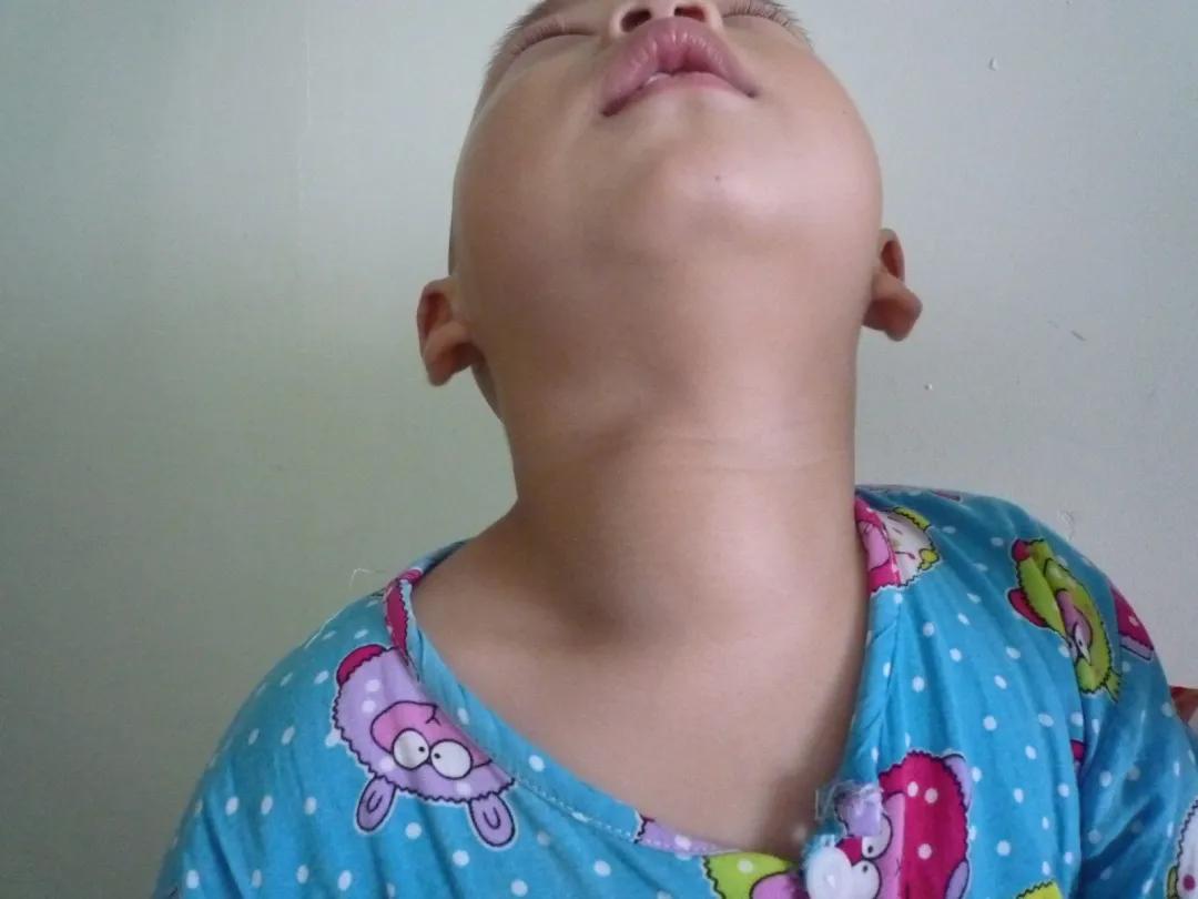 甲狀腺結(jié)節(jié)應(yīng)該掛什么科？一文詳解助您精準就醫(yī)，甲狀腺結(jié)節(jié)詳解，該掛什么科？精準就醫(yī)指南