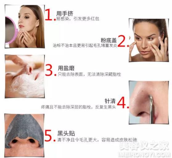 去黑頭的簡單小妙招，去黑頭小妙招分享，輕松告別黑頭困擾