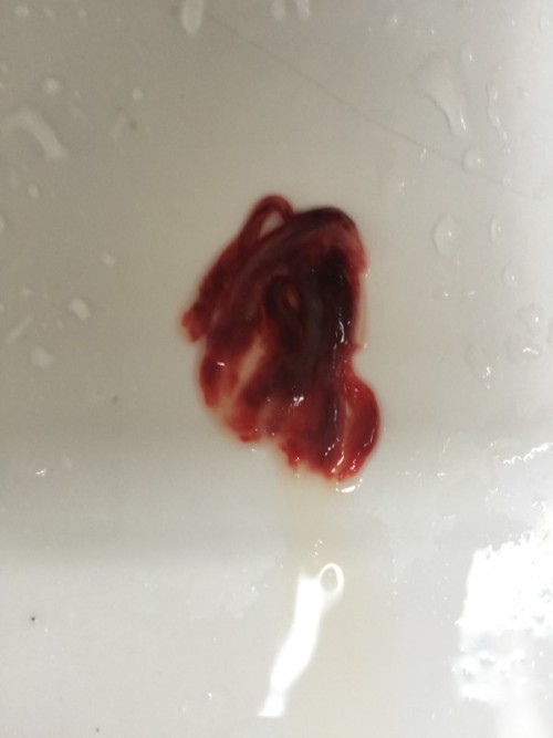 經(jīng)期排出淤血的技巧，優(yōu)化你的生理健康與生活質(zhì)量，經(jīng)期淤血排除技巧，提升生理健康與生活質(zhì)量之道