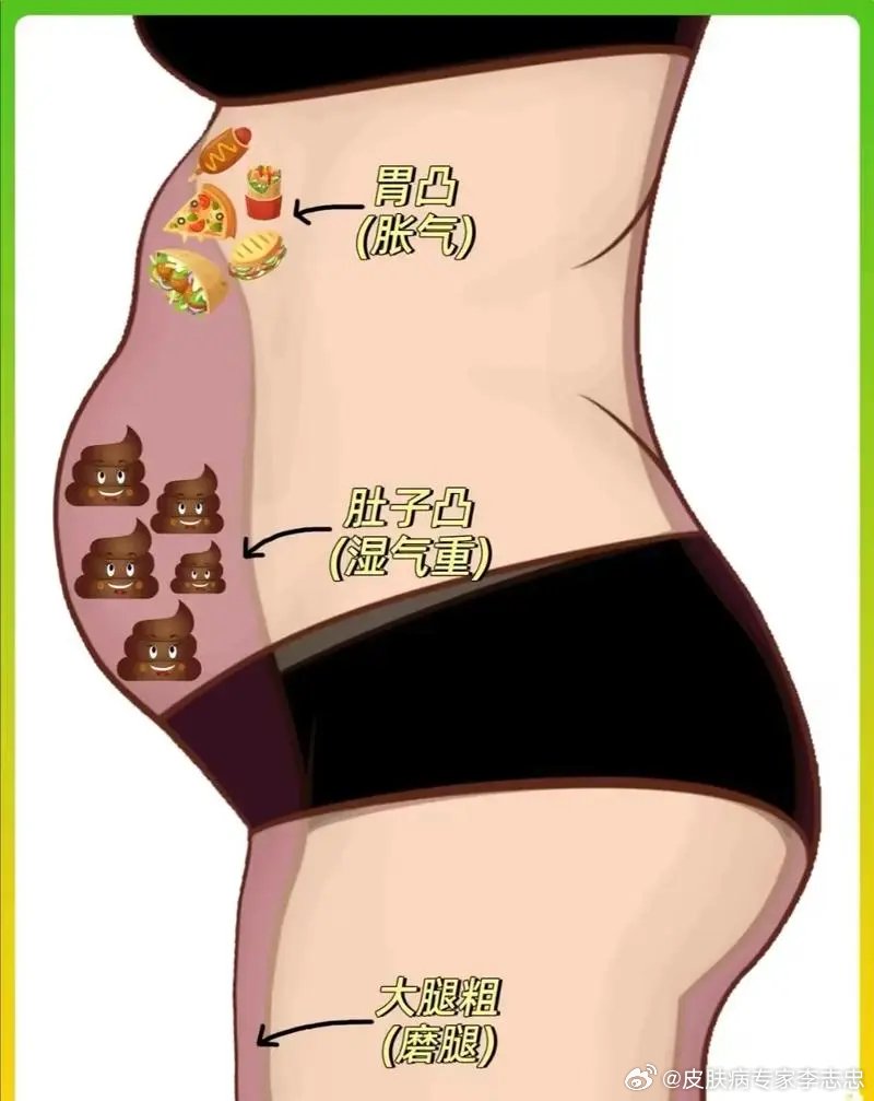 肚子大是濕氣重的原因嗎，肚子大是濕氣重引起的嗎？