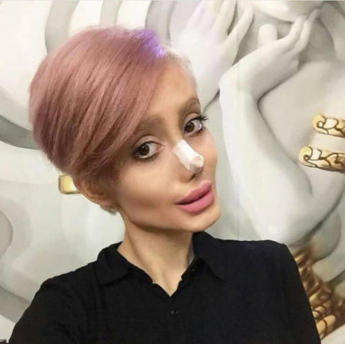 整容最瘋狂的女人，背后的故事與心理探索，整容狂熱背后的女人故事與心理揭秘