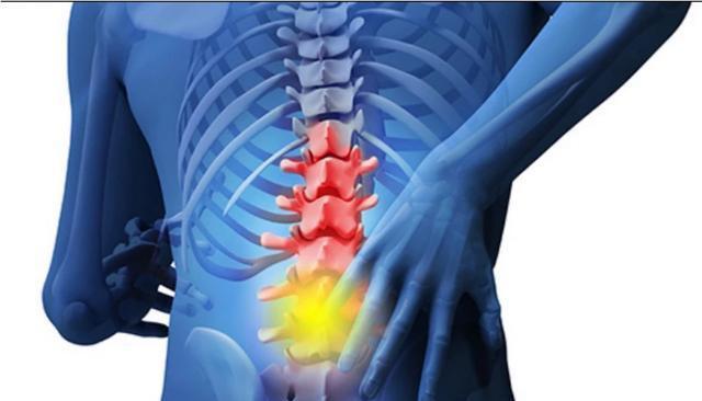 腰疼是什么原因引起的——全面解析腰痛的潛在原因及應(yīng)對之策，腰疼成因深度解析，腰痛背后的潛在原因與應(yīng)對之法