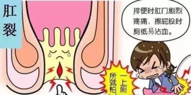 肛裂怎么快速愈合，藥物治療與護理建議，肛裂快速愈合方法，藥物治療與護理建議攻略
