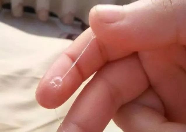 排卵期水灘現(xiàn)象解析