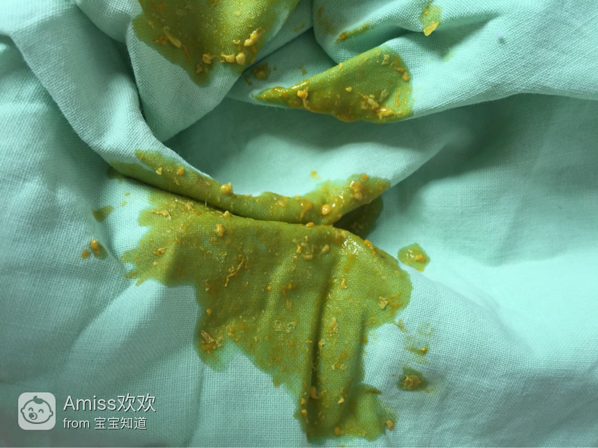 十來天的嬰兒老是拉稀怎么辦？全面解析寶寶腹瀉應(yīng)對之策，嬰兒腹瀉應(yīng)對指南，全面解析寶寶拉稀怎么辦？