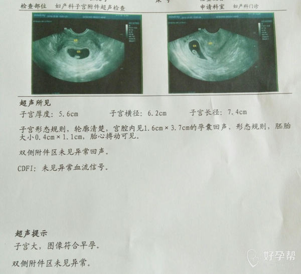懷孕十天自己流掉了，這是否被稱為流產(chǎn)？，懷孕十天自然流產(chǎn)，是否稱為流產(chǎn)？