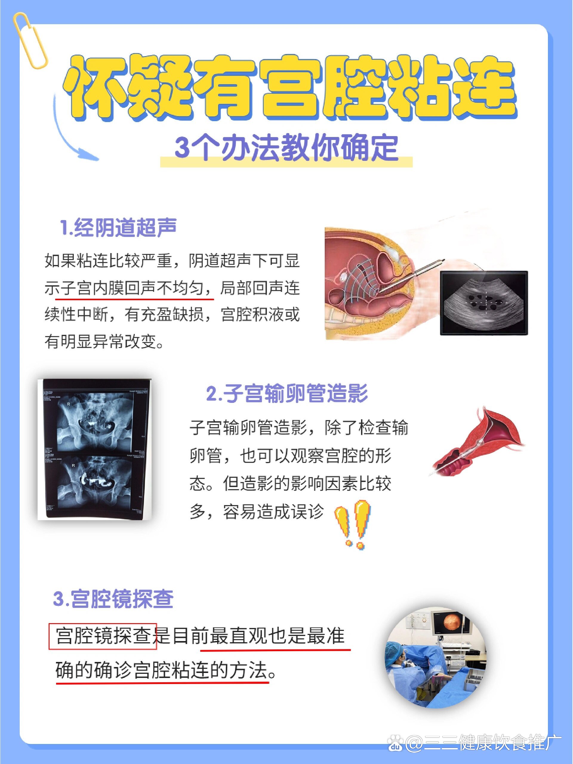 宮腔粘連自檢方法及其重要性，宮腔粘連自檢方法及其重要性解析