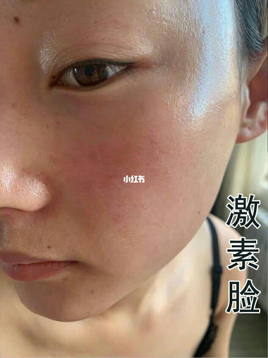 面部激素臉圖片及其相關(guān)問題解析，面部激素臉圖片解析及相關(guān)問題探討