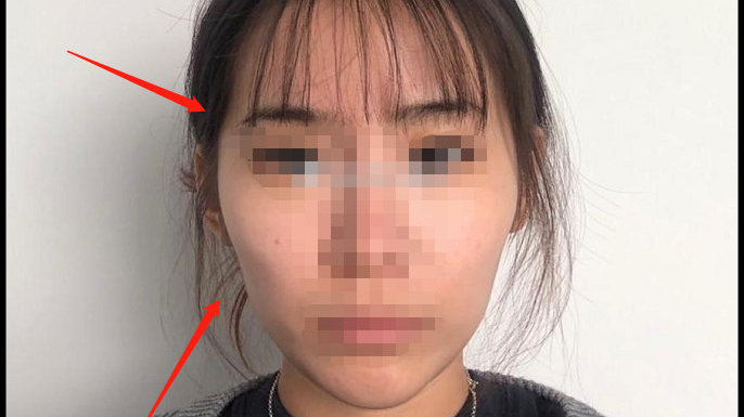 顴骨突出臉型圖，解析臉型特點(diǎn)與修飾技巧，顴骨突出臉型解析及修飾技巧圖解