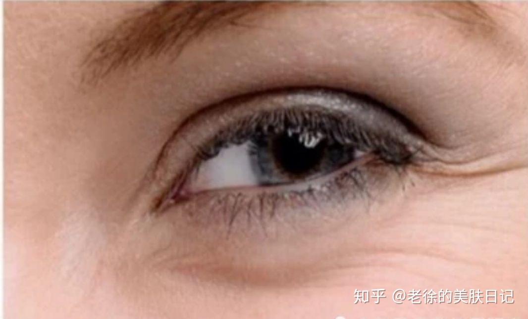 去掉眼睛下細紋妙招，全方位護膚指南，全方位護膚秘籍，消除眼睛細紋的有效妙招