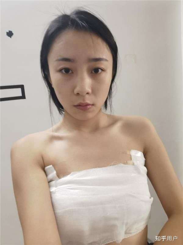 隆胸五年的感受，我的親身經(jīng)歷與體驗分享，隆胸五年的真實感受，我的親身經(jīng)歷與深度體驗分享