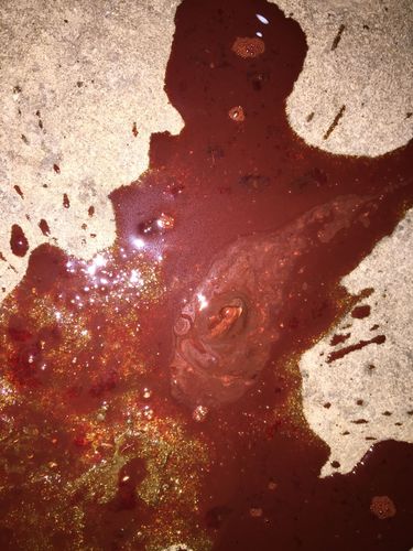 男性拉血是怎么回事？解讀便血現(xiàn)象及其原因，男性便血現(xiàn)象解析，原因及應(yīng)對(duì)方法