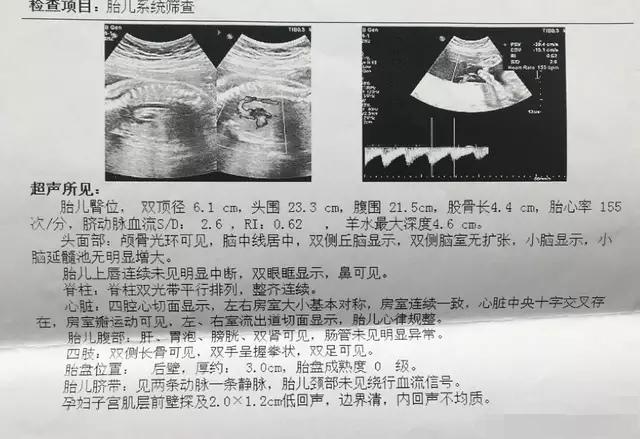 殲-11B重型戰(zhàn)斗機(jī)，卓越性能與先進(jìn)技術(shù)的完美結(jié)合，殲-11B重型戰(zhàn)斗機(jī)，卓越性能與技術(shù)的巔峰融合