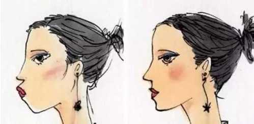 鼻子整形后能否永久保持？全面解析鼻子整形手術(shù)的持久性，鼻子整形手術(shù)的持久性與永久保持的可能性解析