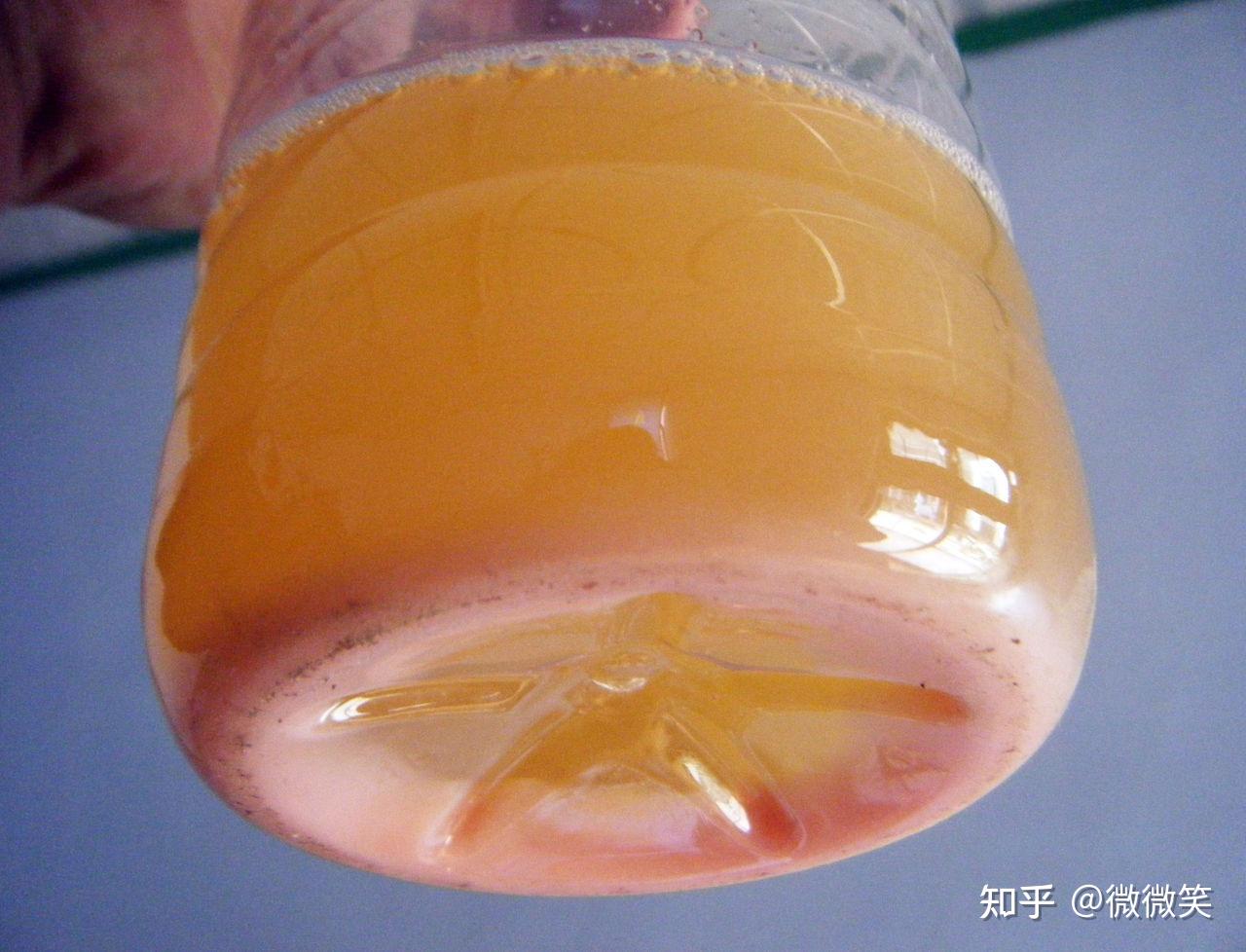 蛋白尿可以自愈嗎？解析真相與關(guān)鍵注意事項，蛋白尿能否自愈？解析真相及注意事項