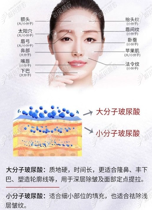 玻尿酸的作用與功效，深入了解玻尿酸的奧秘，玻尿酸的作用與功效揭秘，深入了解玻尿酸的神奇之處