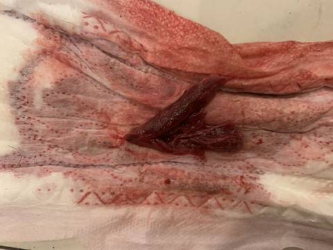 月經(jīng)排出爛肉是好事嗎？解讀月經(jīng)中的異物及其背后的健康信號，月經(jīng)排出爛肉現(xiàn)象解析，月經(jīng)中的異物與健康信號探討