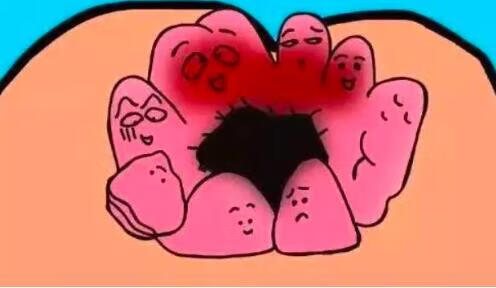 屁眼上面長了個小肉球，原因、診斷與治療方法，屁眼上長肉球，原因、診斷與治療方法全解析