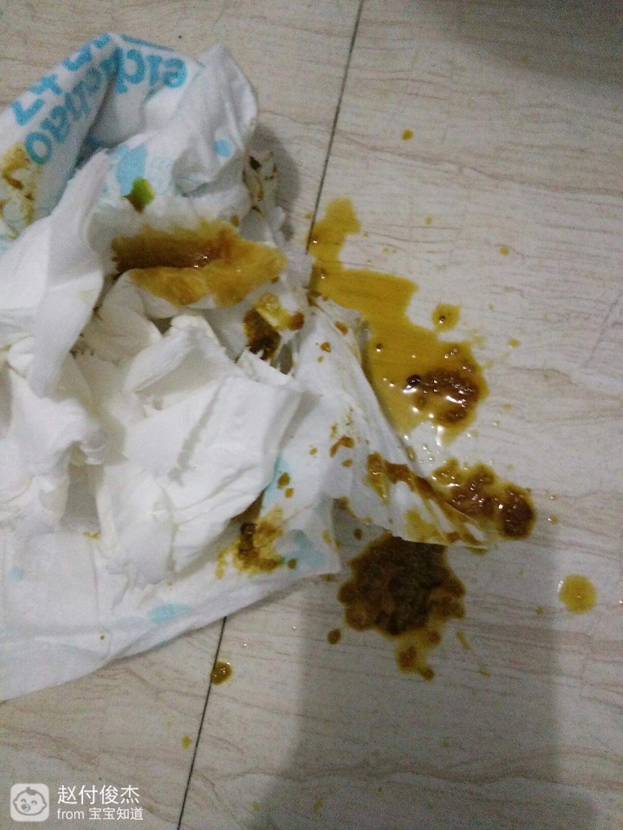 寶寶腹瀉一進(jìn)食就拉，原因、應(yīng)對措施與預(yù)防方法，寶寶腹瀉，進(jìn)食即拉的原因、應(yīng)對措施及預(yù)防方法全解析