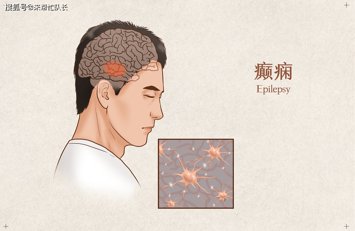 癲瘋病會遺傳下一代嗎，癲癇病遺傳問題，是否會傳給下一代？